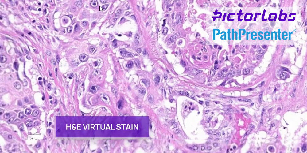 Slide image with Pictor Labs virtual H&E staining