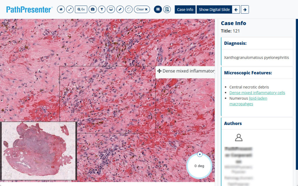 PathPresenter high yield case