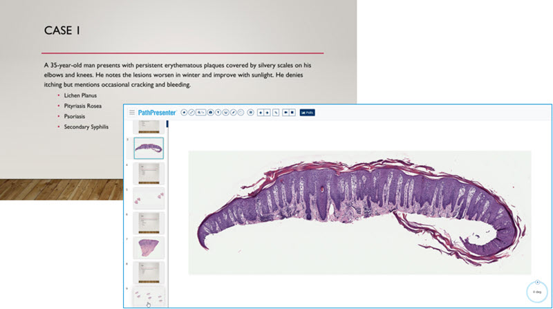 Dermpath case example