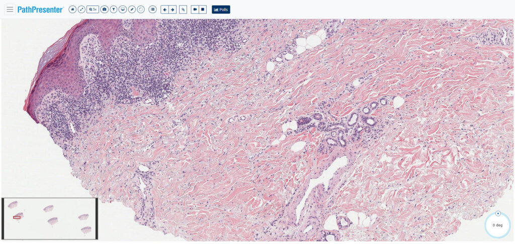 Case 4