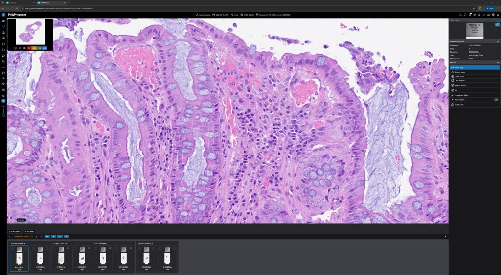 PathPresenter's clinical viewer now carries both FDA 510(k) clearance and CE-IVDR certification