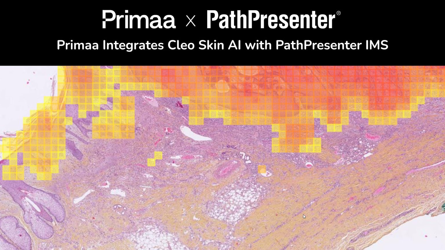 Primaa Integrates Cleo Skin AI with PathPresenter IMS | PathPresenter ...